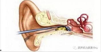 掏耳屎吃瓜,揭秘日常生活中的趣味小习惯